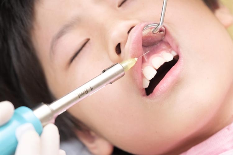 麻酔針の刺入方法を工夫する
